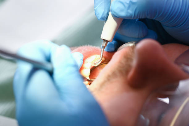 Best Urgent Dental Care for Toothache in Rutgers University Busch Campus, NJ