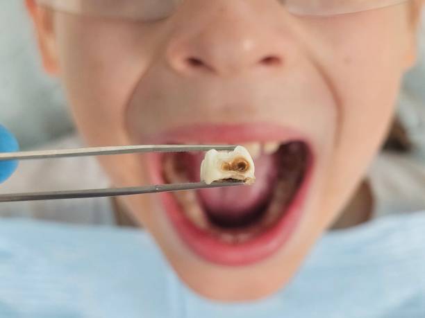 Best Emergency Cosmetic Dentistry in Rutgers University Busch Campus, NJ