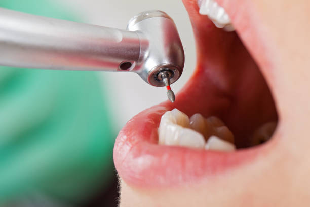 Best Emergency Dental Services for Seniors in Rutgers University Busch Campus, NJ